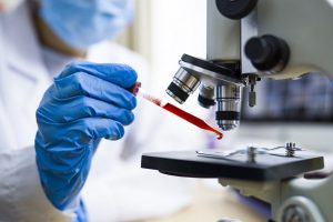 ICMR sets new protocol for rapid antibody test to detect COVID-19 in hotspot areas