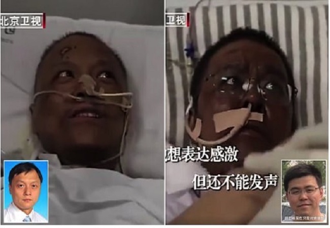 Infected Chinese doctor’s skin turns dark after undergoing treatment for COVID-19