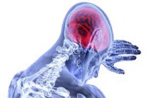 Stroke survivors more likely to attempt Suicide