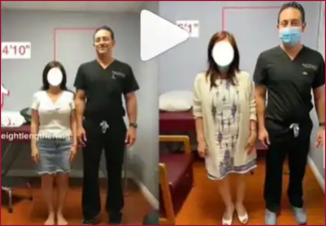 THIS doctor claims he can stretch patients’ limbs by up to 5.6 inches; Viral video