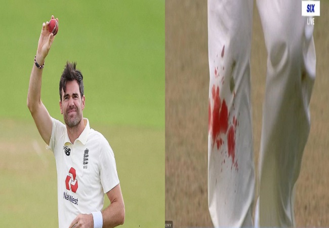 Anderson bowls with bleeding knee, Netizens awestruck by his dedication