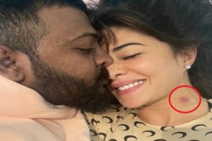 Jacqueline Fernandez flaunts love bite on neck in new leaked photo with conman Suresh Chandrasekhar