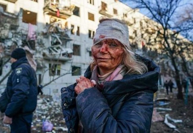 Blood-soaked face of Ukrainian teacher who survived Russian attack is the ‘Face of War’