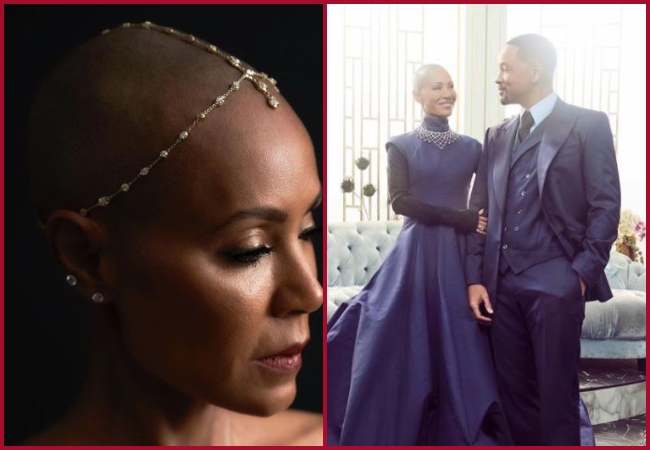 What is Alopecia Areata?: Will Smith’s wife Jada Pinkett Smith suffers from this Autoimmune Disorder