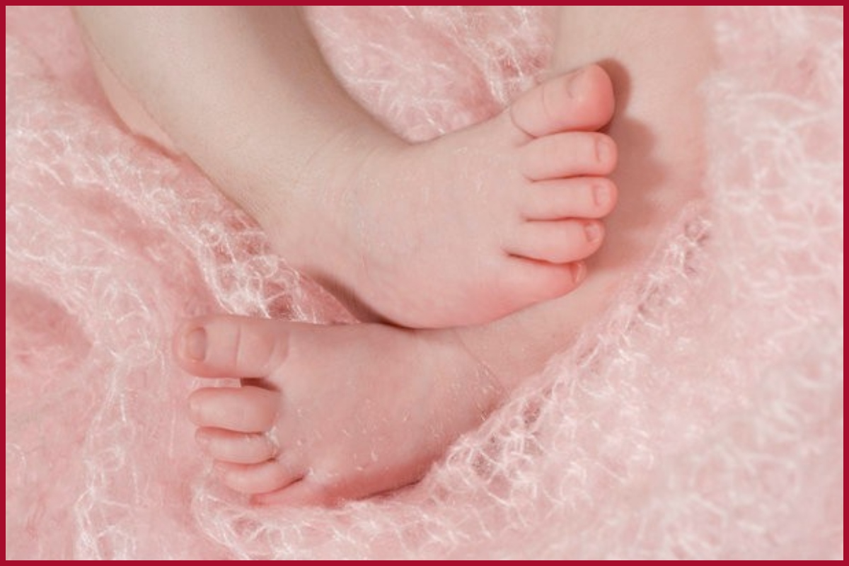 New born Baby Legs. Bowed Legs in Babies. 1 Month Baby Legs. New born Baby Legs Sweety.