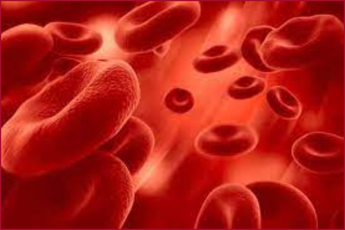 What is Thalassemia? Check Symptoms and Causes