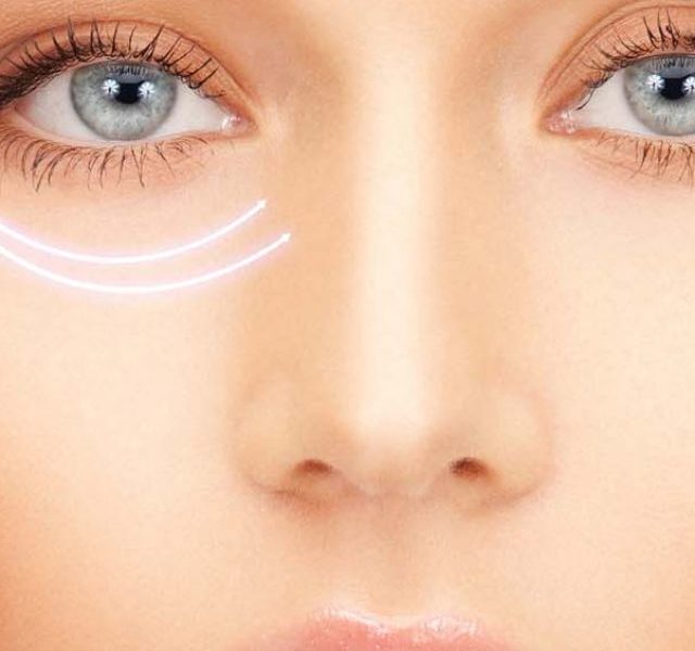 Ways to get rid of dark circles