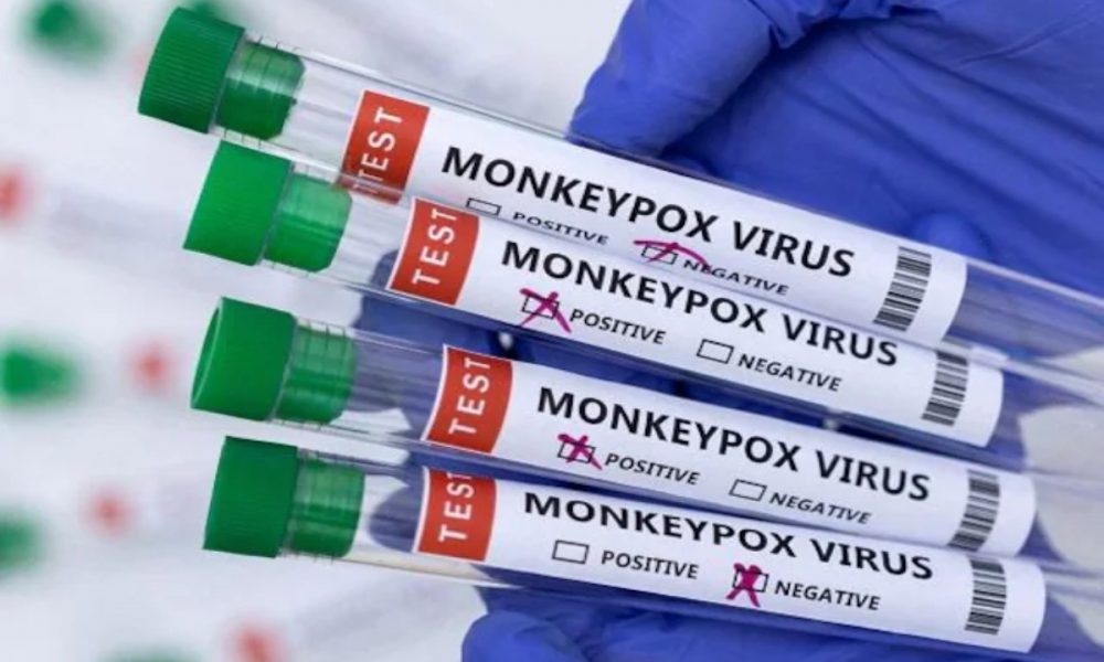 14th monkeypox case reported in India, 9th in Delhi: Official sources
