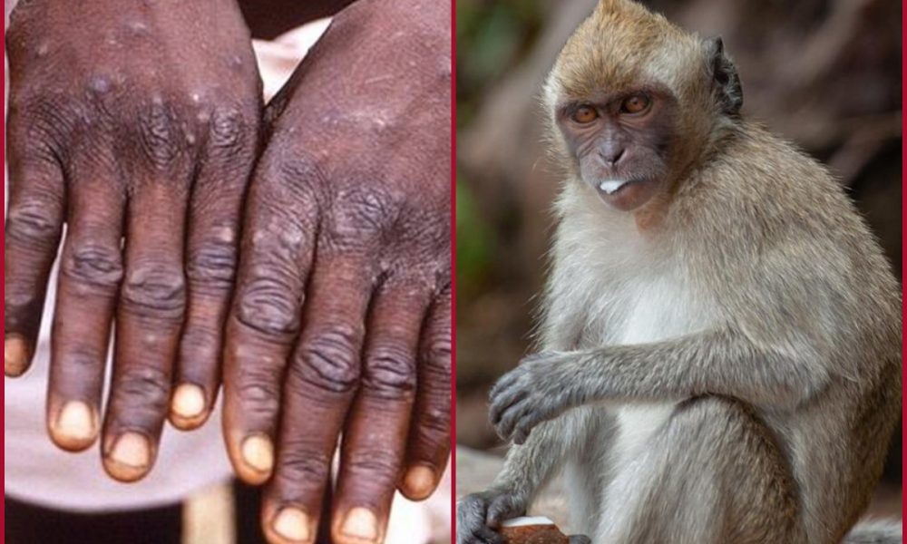 What is monkeypox? Know here how to protect yourself from monkeypox virus