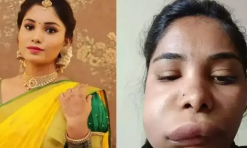 Kannada actress Swathi Sathish’s root canal surgery goes wrong, makes her look unrecognizable