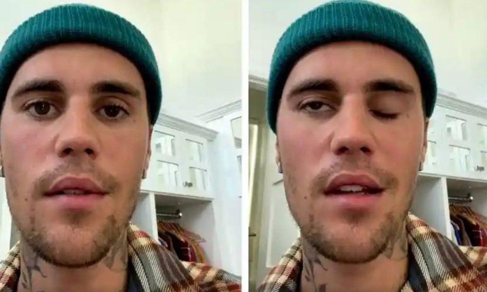 Half of Justin Beiber’s face paralysed by serious virus, cancels shows