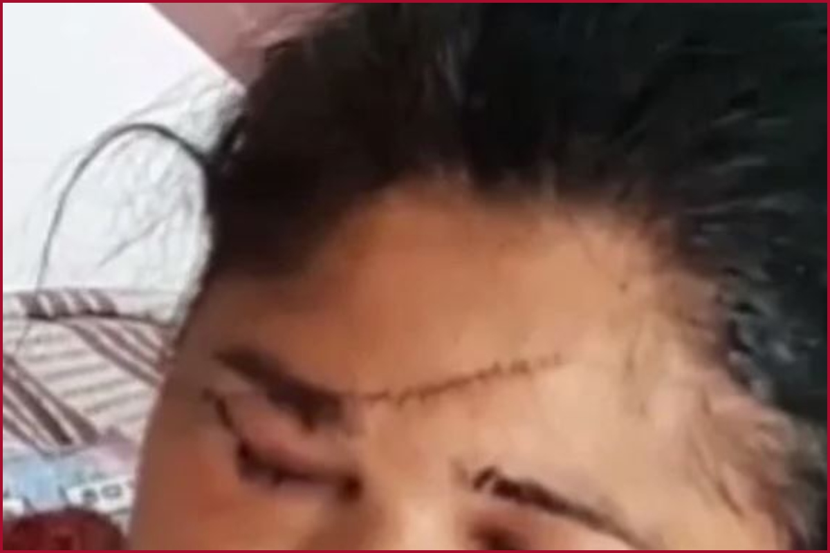 Bhopal: Woman attacked with blade received 118 stitches on face, for resisting eve teasing
