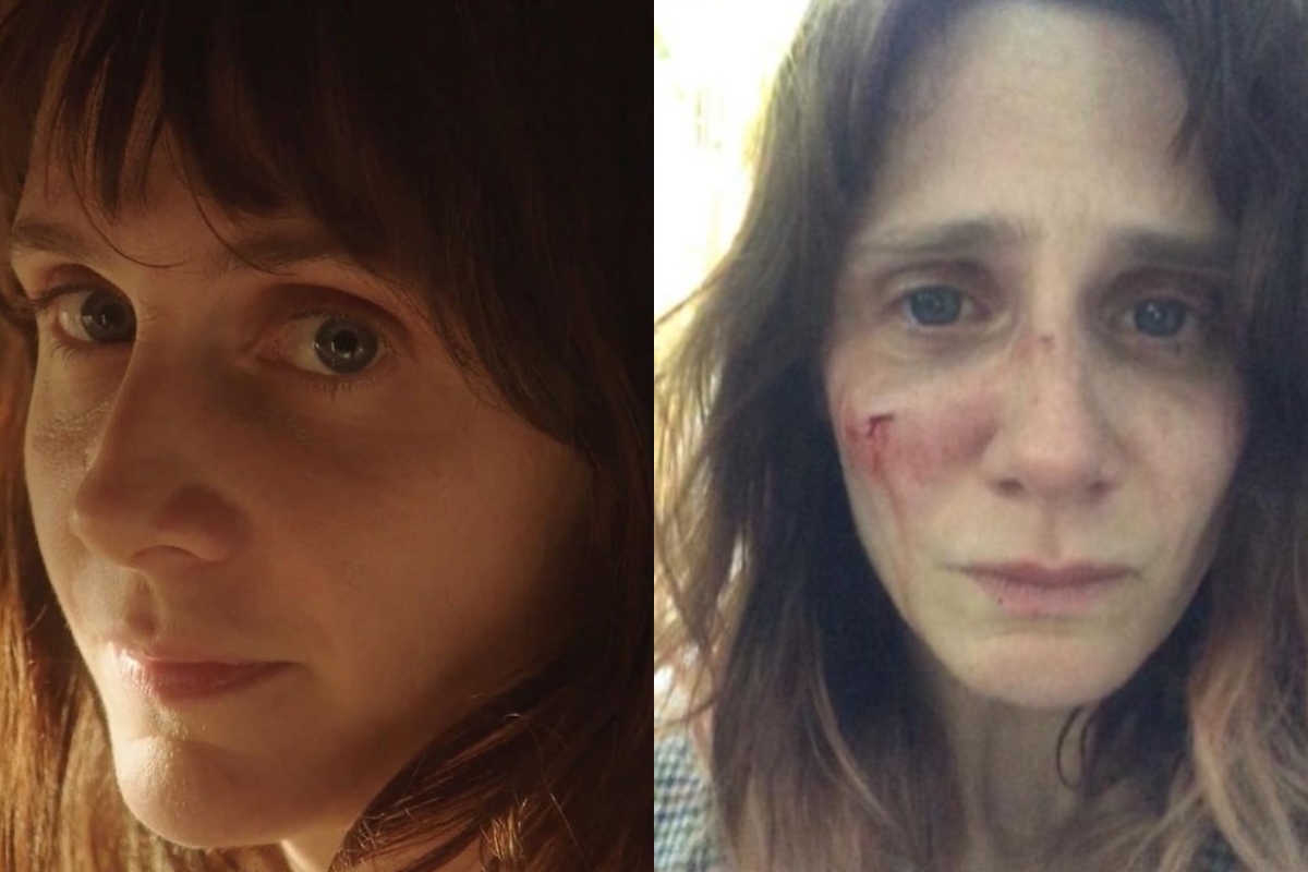 Actor Judith Chemla shares photos of ‘injuries’ stemming from domestic abuse
