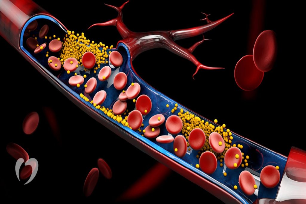 Here are some ways for lowering your cholesterol through lifestyle changes