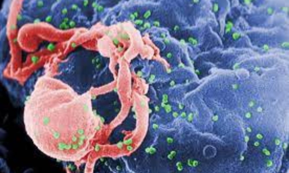 What are the causes of HIV and its symptoms?