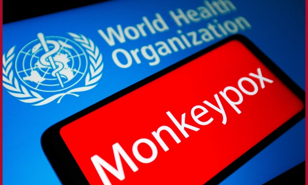Monkeypox virus: Know Do’s, don’ts to prevent spread