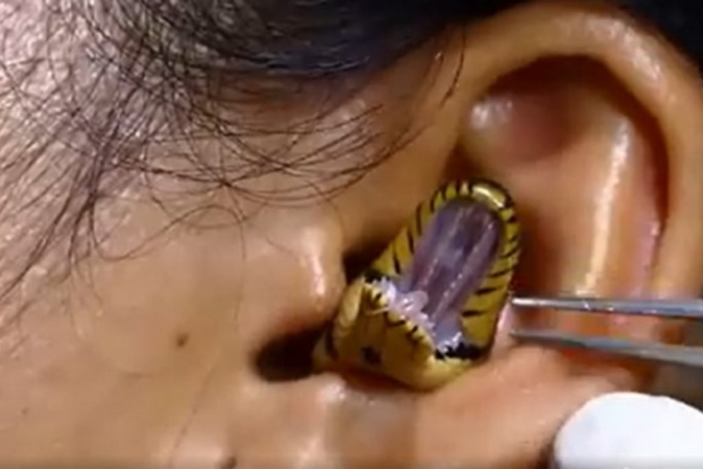 Pet Snake Gets Stuck in Womans Ear Piercing Hole
