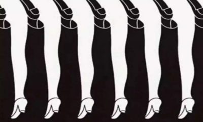 Optical Illusion: Male or female leg