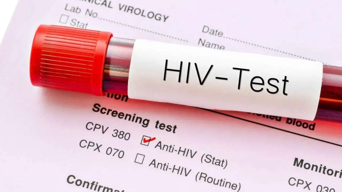 HIV test