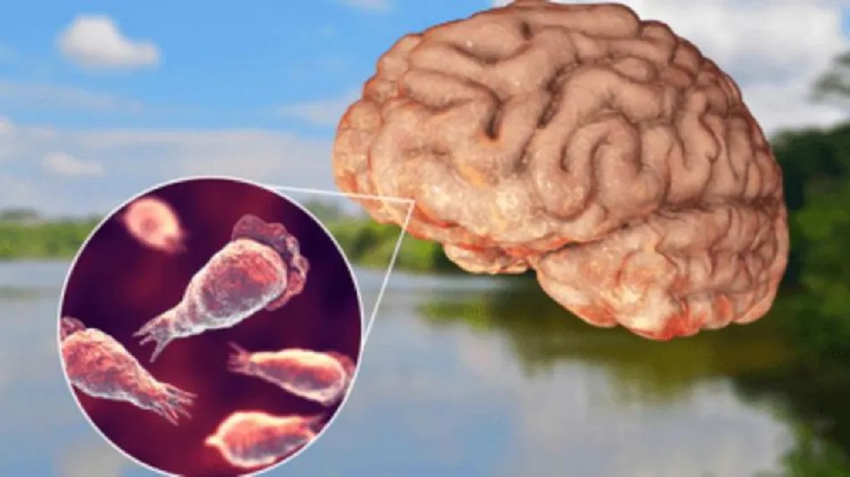 What is Naegleria fowleri? A ‘braineating amoeba’ that claimed 1st