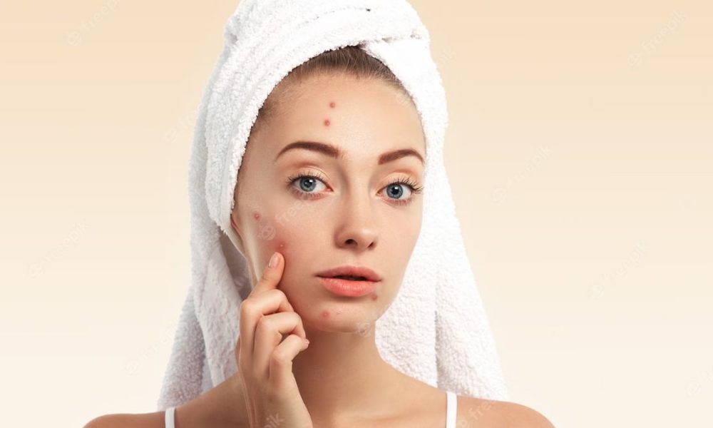 Cautions for Your Complexion: What to Avoid Applying on Your Face