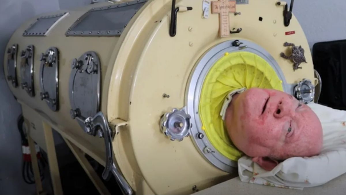 Who was Paul Alexander? Man who spent 7 decades inside an Iron lung and died at 78
