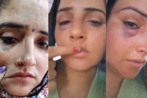 Viral: Seema Haider’s deepfake video showing her with injured face, bruised eye & lips goes viral on internet, netizens react