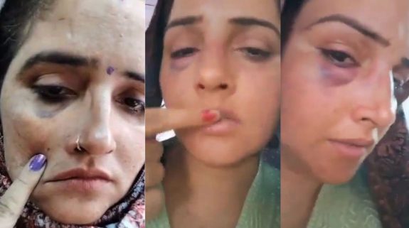 Viral: Seema Haider’s deepfake video showing her with injured face, bruised eye & lips goes viral on internet, netizens react