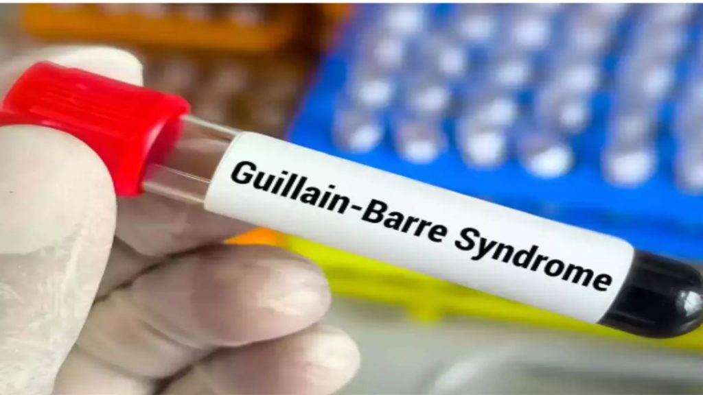 Gullain syndrome